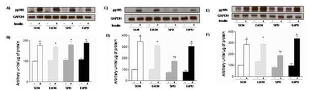 Figure 3. Evaluation of pp185 (IRS-1/IRS-2) tyrosine phosphorylation status before (-) and after (+) insulin stimulus in liver (A and B), gastrocnemius skeletal muscle (C and D), and in periepididymal white adipose tissue (E and F).