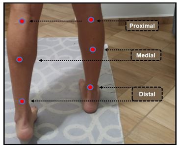 Figure 1. Algometry evaluation point and VAS