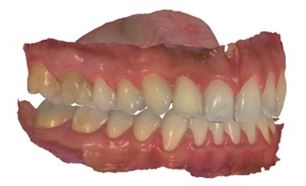 Figure 2. Intraoral scanning